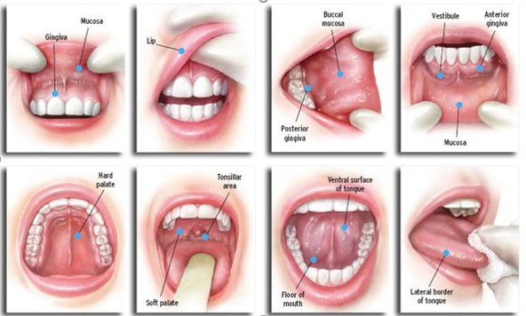 oral cancer diagnoses