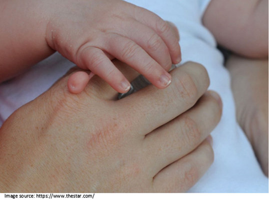 Polydactyly