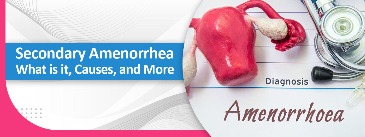 Secondary Amenorrhea Secondary Amenorrhea
