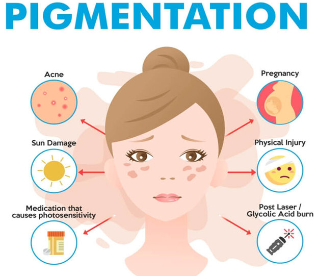 Skin Pigmentation Treatments using Laser Facials | QuikLaser Vancouver