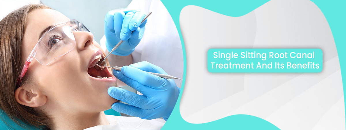 Single Sitting Root Canal Treatment And Its Benefits Single Sitting Root Canal Treatment And Its Benefits
