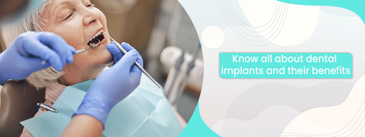 Know all about dental implants and their benefits Know all about dental implants and their benefits