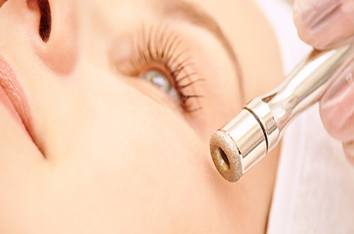 Diamond Microdermabrasion