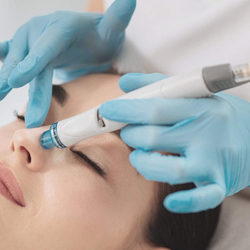 Hydradermabrasion