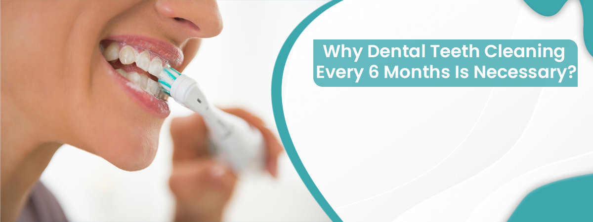 Dental Teeth Cleaning Dental Teeth Cleaning