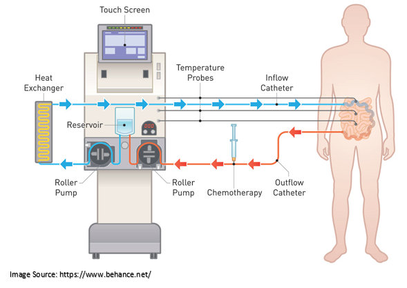 Chemotherapy Bath 