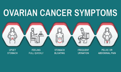 ovarian cancer