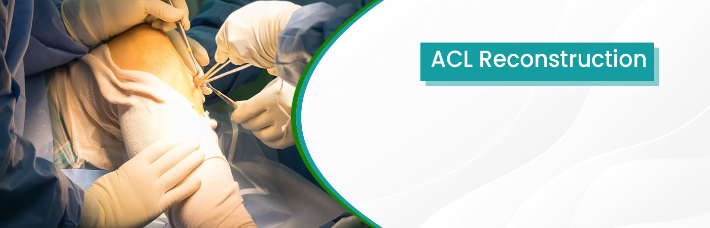 ACL Reconstruction Treatment ACL Reconstruction Treatment