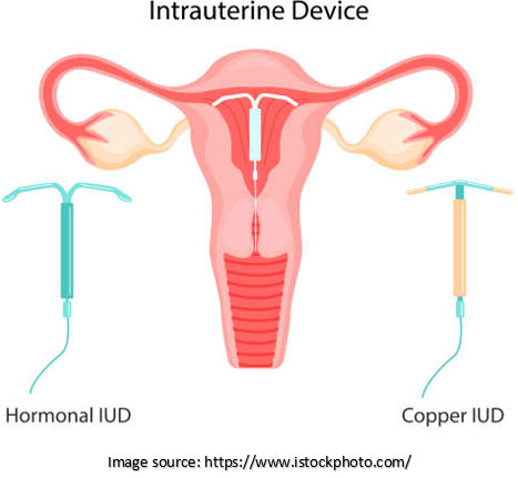 intrauterine devices