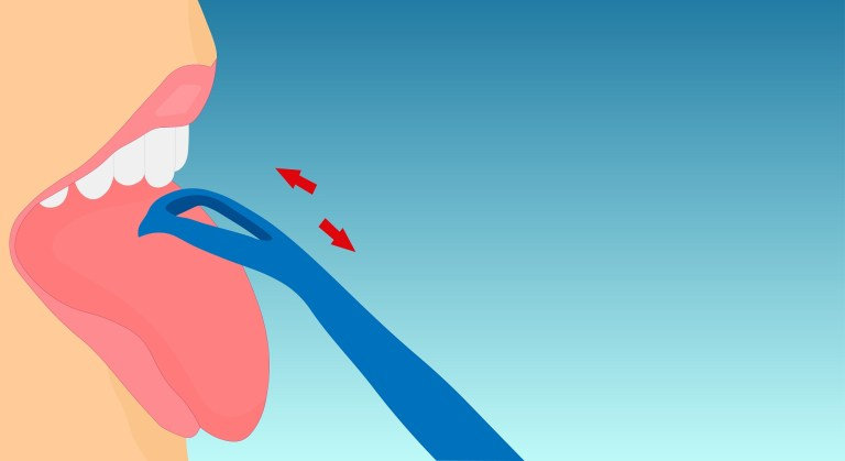 Tongue scraping to make your tongue look better - DentalDost