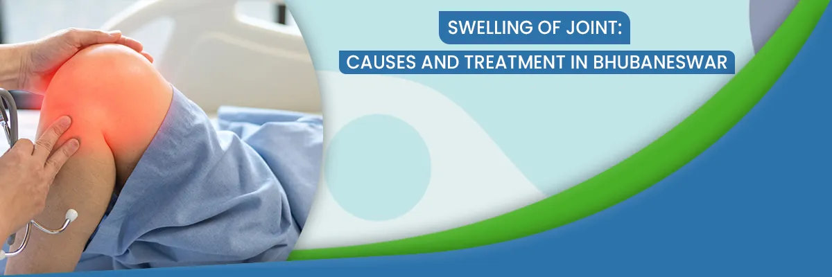Swelling of Joint Swelling of Joint