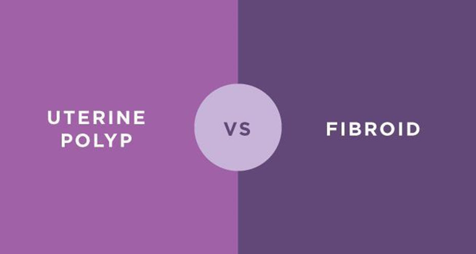  Uterine Polyps And Fibroids