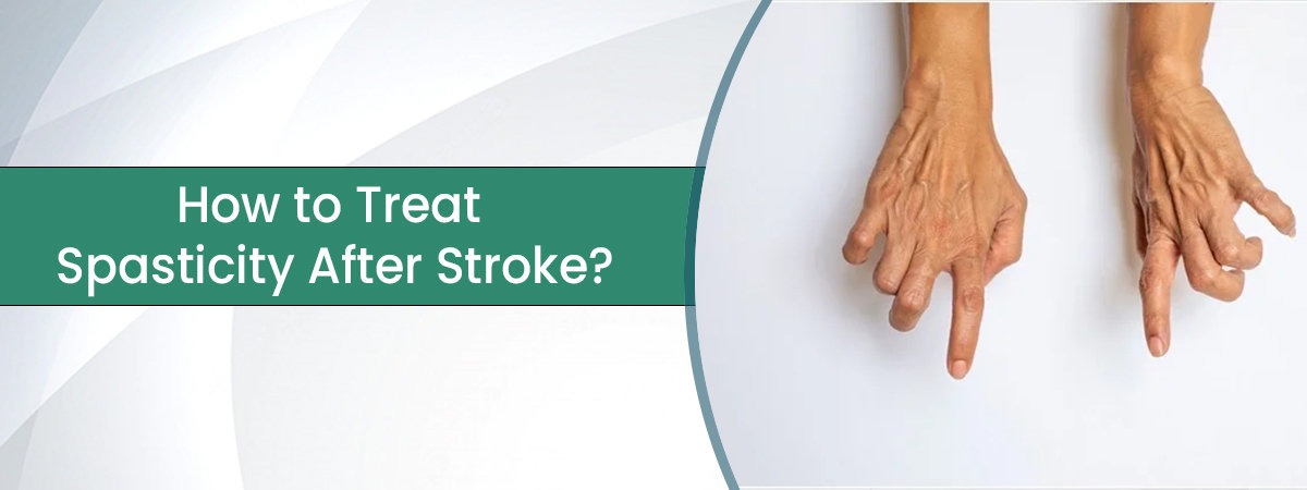 Spasticity After Stroke Spasticity After Stroke