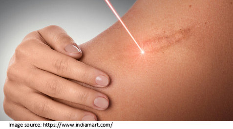 Radiation Therapy
