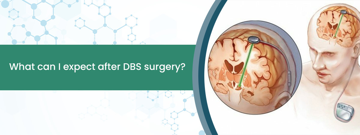 DBS surgery DBS surgery