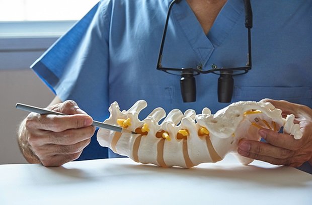 Spine Surgery: Myths Debunked Spine Surgery: Myths Debunked