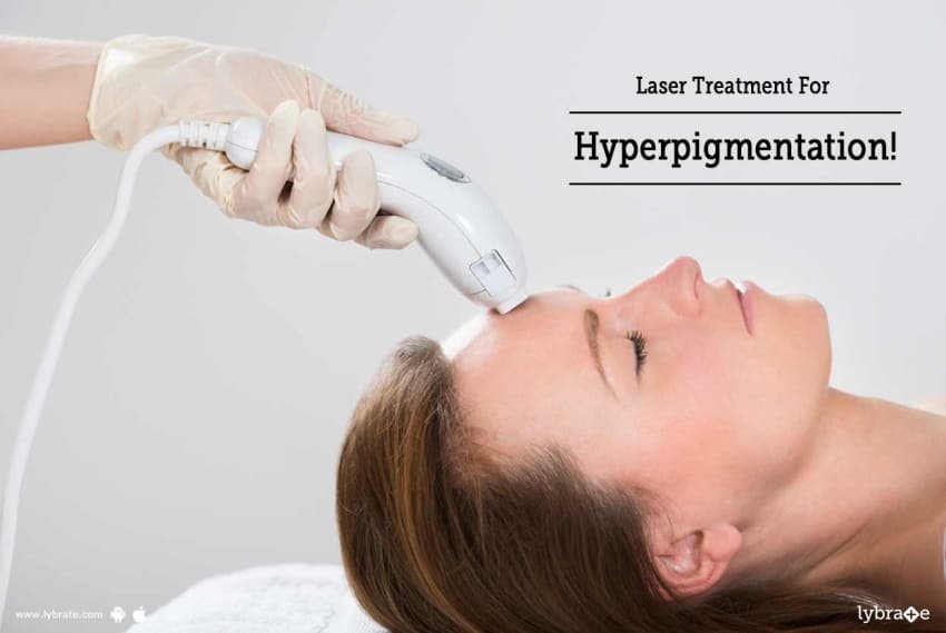 Laser Treatment For Hyperpigmentation!