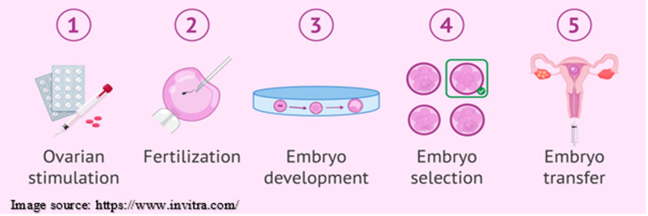 IVF 