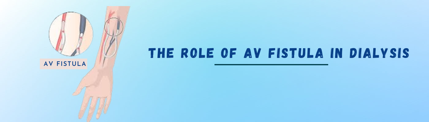 AV fistula In Dialysis AV fistula In Dialysis