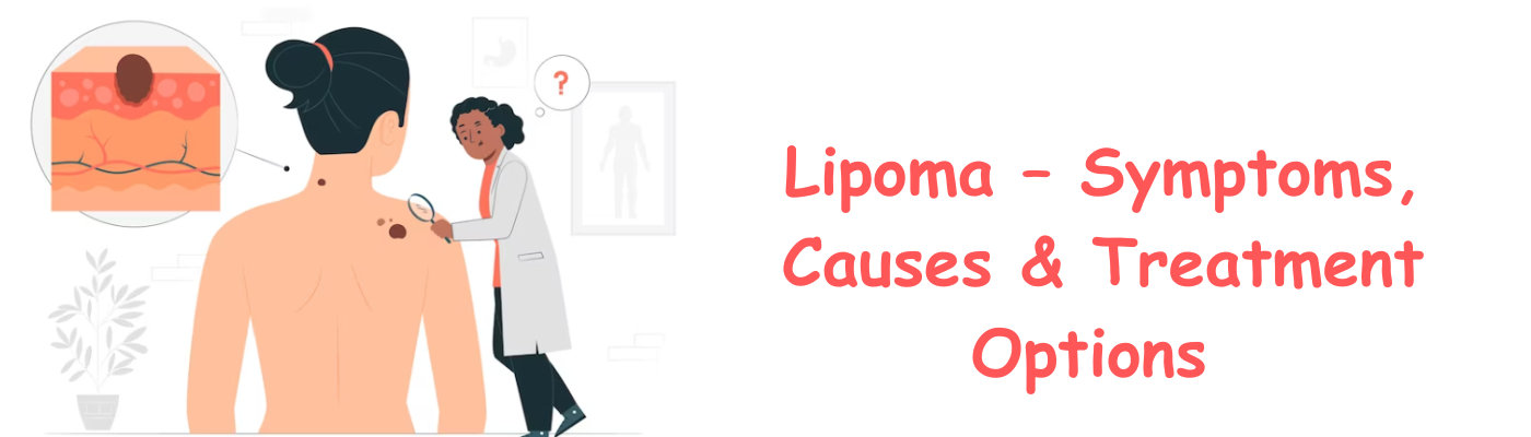 Lipoma Treatment Lipoma Treatment