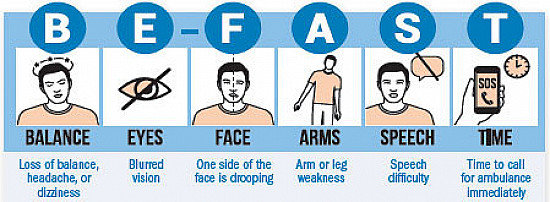 Ministroke: A warning sign of a major problem - Harvard Health