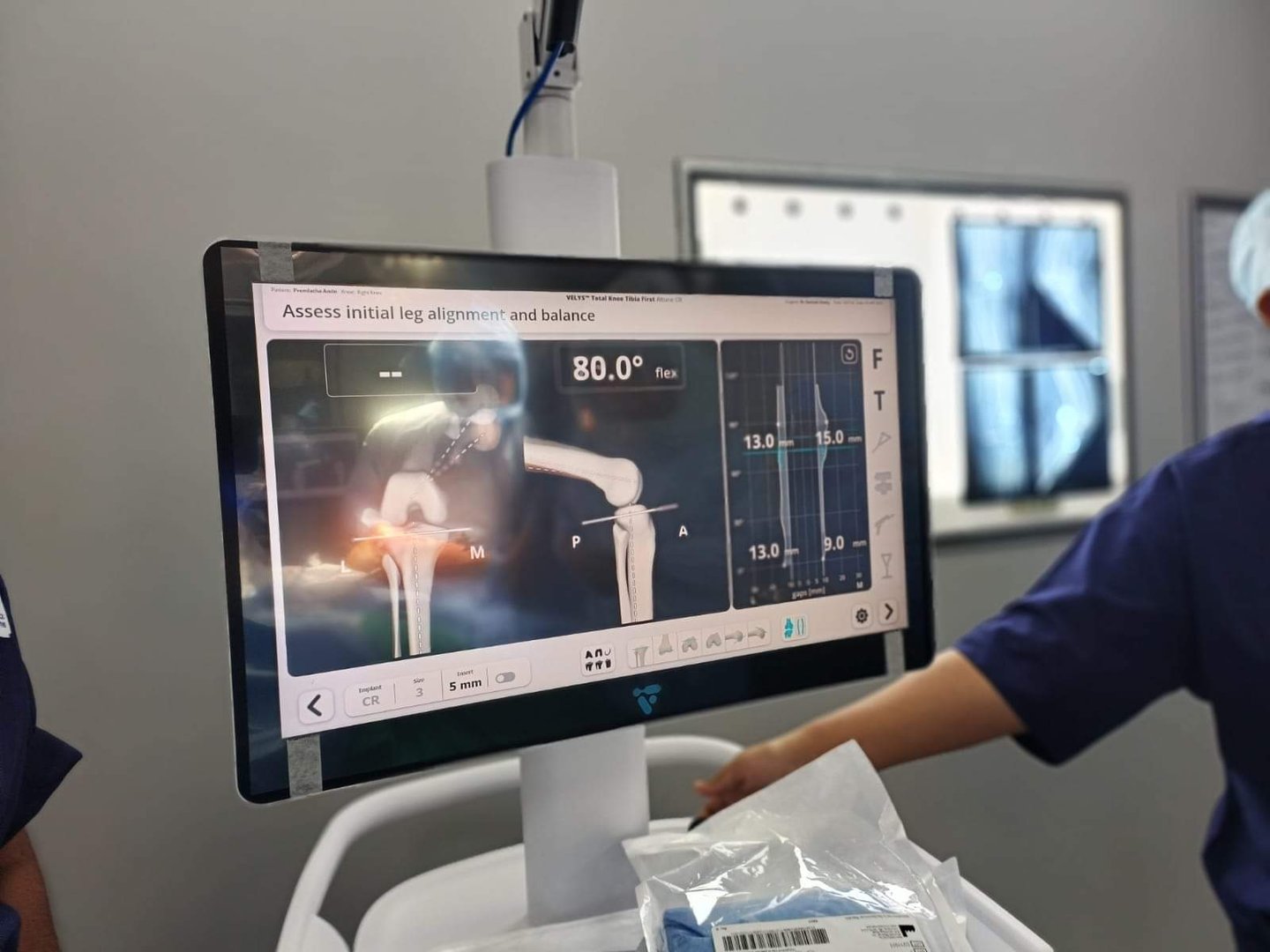 Screen showing results during robotic surgery Screen showing results during robotic surgery