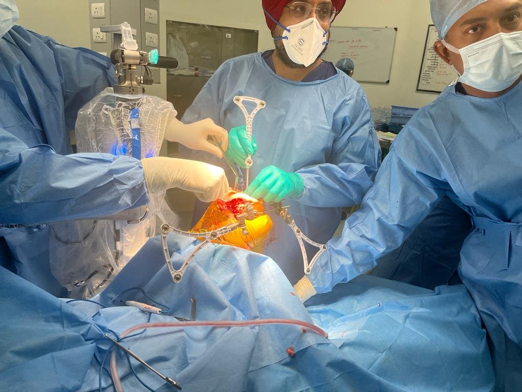 Robotic knee replacement during procedure Robotic knee replacement during procedure