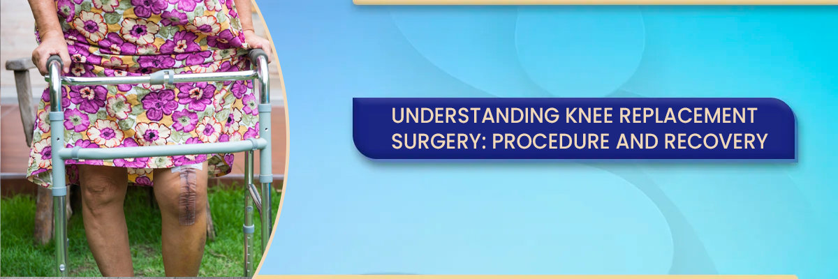 Understanding Knee Replacement Surgery