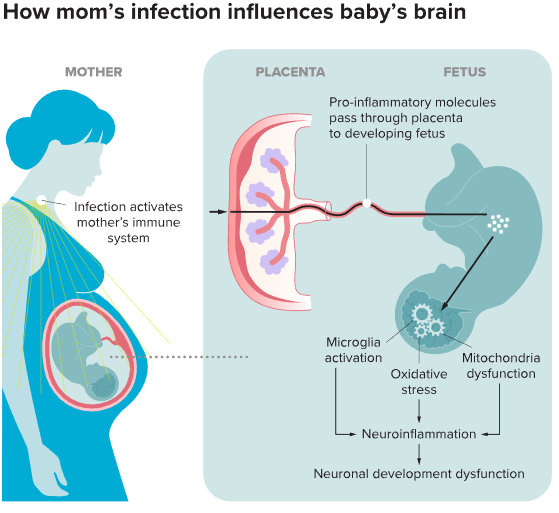 how mom's infection influences baby's brain