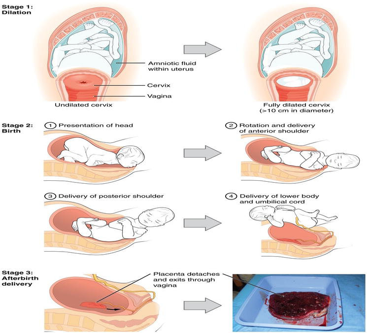 NSVD Process