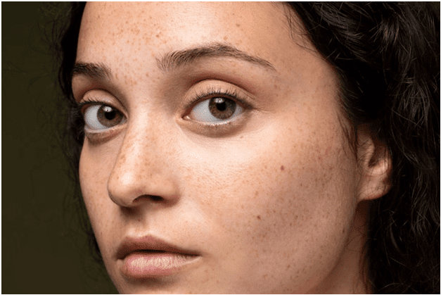 Dermaroller Treatment in Faridabad