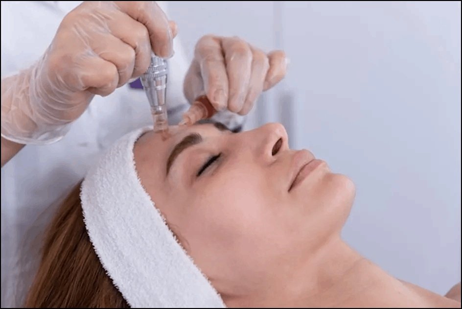  Diamond Microdermabrasion Facial