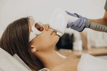 skin laser treatment