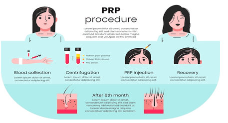 Hair transplant cost