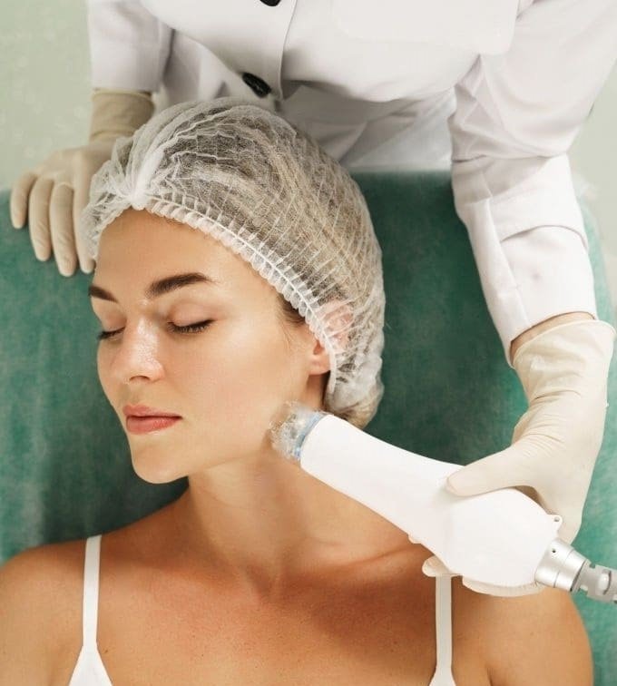 Microneedling Radiofrequency