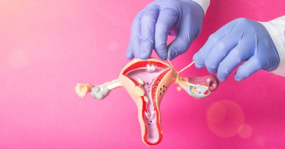 Pregnant after tubal ligation