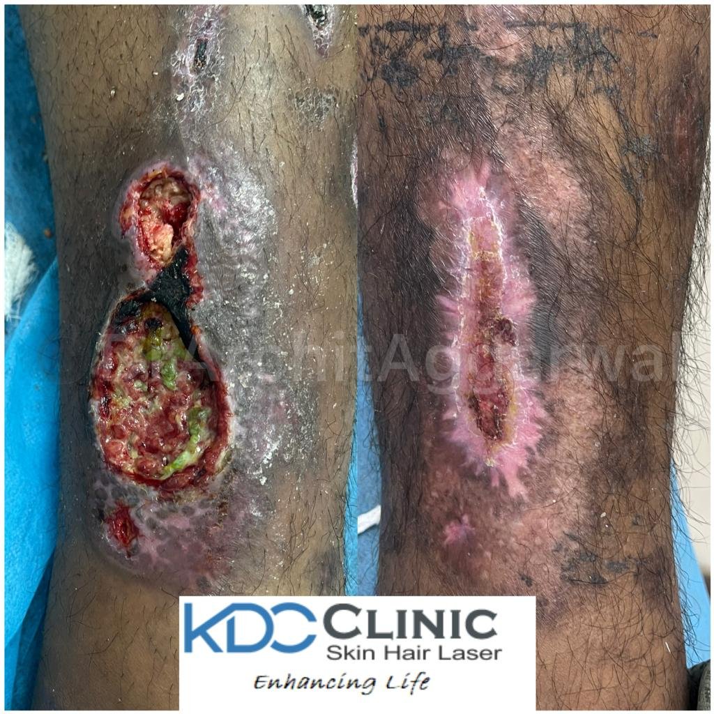 skin-hair-laser-treatment skin-hair-laser-treatment
