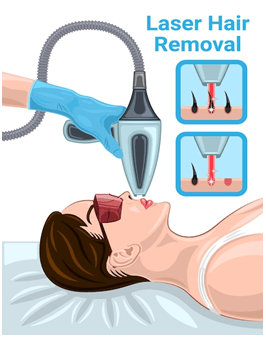 laser-hair-removal