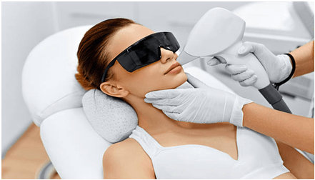 Laser treatment for face hair removal