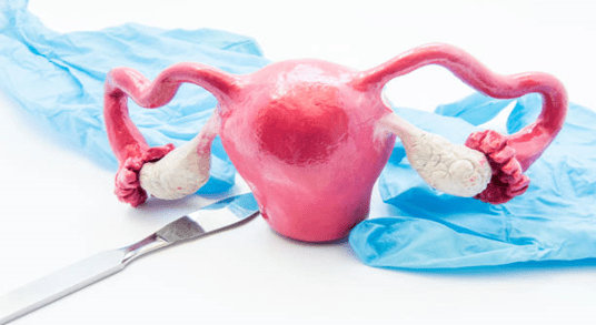 What Happens When the Uterus is Removed from the Female Body