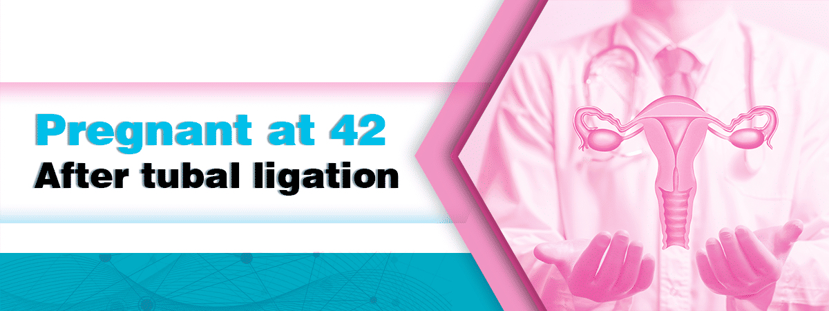 Pregnant at 42 after tubal ligation Pregnant at 42 after tubal ligation