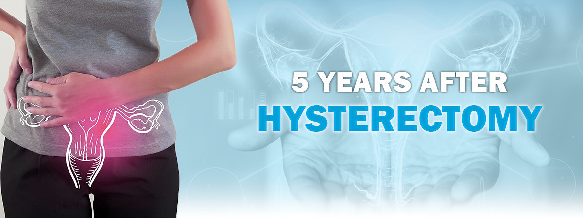 5 Years After Hysterectomy 5 Years After Hysterectomy