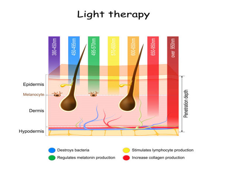 Types of Phototherapy Used for Psoriasis