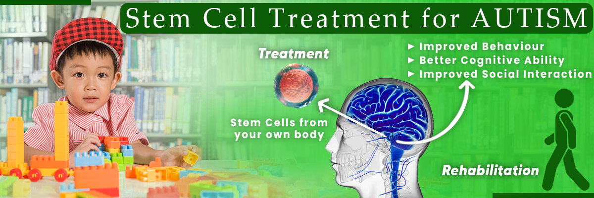 Stem Cell Treatment 