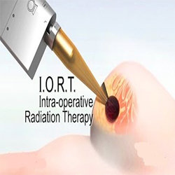 IORT