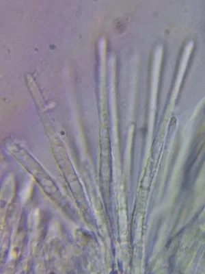 Photo of Dasyscyphella nivea taken at Sonyea State Forest