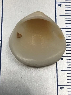 Photo of Glycymeris spectralis taken at Deerfield Beach