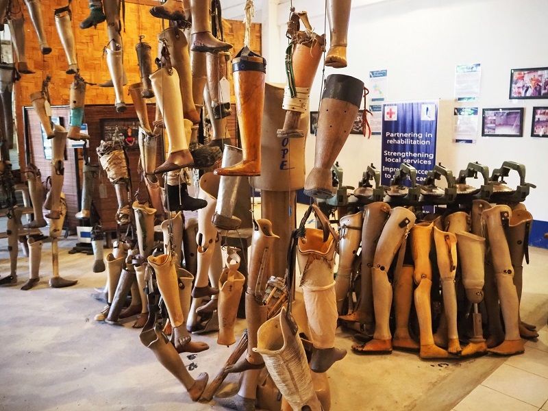 Prosthetic limbs at the Vientiane COPE Centre in Laos