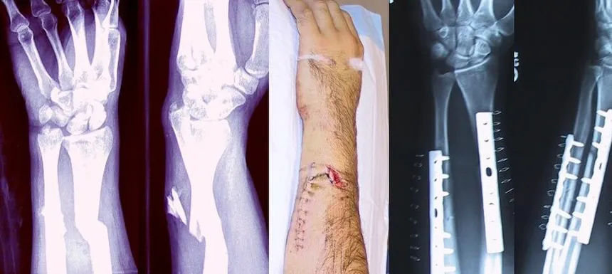 bones.webp