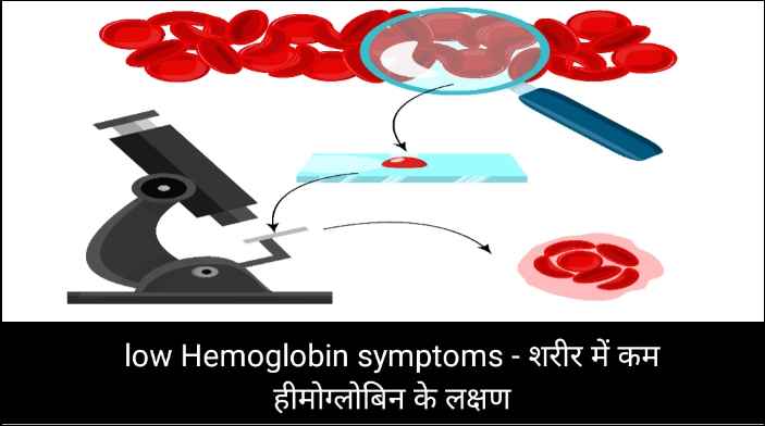 low Hemoglobin symptoms